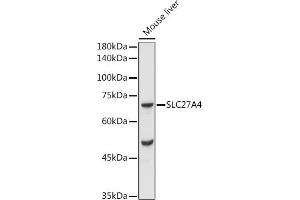 Western blot analysis of extracts of Mouse liver, using F/SLC27 antibody (ABIN7270444) at 1:1000 dilution. (SLC27A4 antibody  (AA 574-643))