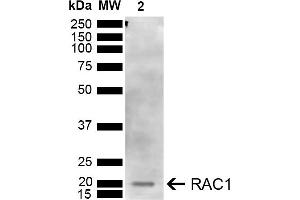 Western blot analysis of Human Embryonic kidney epithelial cell line (HEK293T) lysate showing detection of ~21 kDa RAC1 protein using Rabbit Anti-RAC1 Polyclonal Antibody (ABIN5667642).