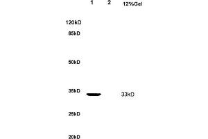 L1 rat kidney lysate L2 rat brain lysates probed with Anti Nucleophosmin Polyclonal Antibody, Unconjugated (ABIN1387533) at 1:200 overnight at 4 °C. (NPM1 antibody  (AA 21-120))