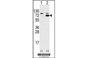 Western blot analysis of SWAP70 using rabbit polyclonal SWAP70 Antibody using 293 cell lysates (2 ug/lane) either nontransfected (Lane 1) or transiently transfected with the SWAP70 gene (Lane 2). (SWAP70 antibody  (AA 227-256))