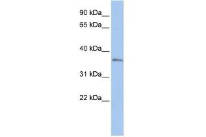 WB Suggested Anti-SIX3 Antibody Titration:  0. (SIX3 antibody  (N-Term))