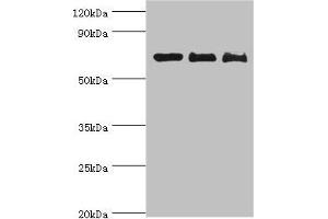 Western blot All lanes: CD6 antibody at 4 μg/mL Lane 1: Hela whole cell lysate Lane 2: Jurkat whole cell lysate Lane 3: HT-29 whole cell lysate Secondary Goat polyclonal to rabbit IgG at 1/10000 dilution Predicted band size: 72, 69, 64, 65, 59, 61 kDa Observed band size: 72 kDa (CD6 antibody  (AA 424-668))
