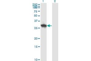 Western Blot analysis of DCUN1D1 expression in transfected 293T cell line by DCUN1D1 monoclonal antibody (M01), clone 3D7.