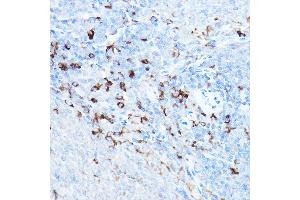 Immunohistochemistry of paraffin-embedded rat spleen using cI Rabbit pAb (ABIN1678920, ABIN3015349, ABIN3015350 and ABIN6213998) at dilution of 1:25 (40x lens). (BIRC3 antibody  (AA 1-180))