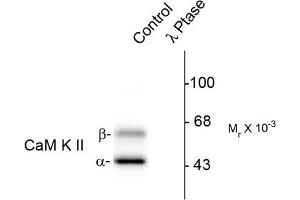 Image no. 1 for anti-Calcium/calmodulin-Dependent Protein Kinase II alpha (CAMK2A) (pThr286) antibody (ABIN372889) (CAMK2A antibody  (pThr286))