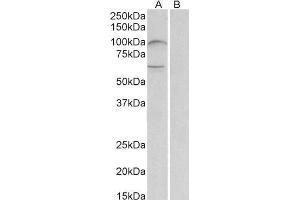ABIN1781816 (2µg/ml) staining of Human Bone Marrow lysate (35µg protein in RIPA buffer) with (B) and without (A) blocking with the immunizing peptide. (UNC5B antibody  (AA 629-643))