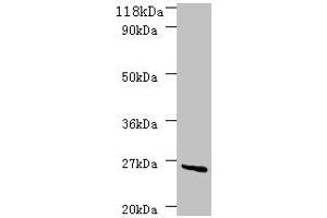 Western blot All lanes: deoD antibody at 2 μg/mL + DH5a whole cell lysate Secondary Goat polyclonal to rabbit IgG at 1/10000 dilution Predicted band size: 26 kDa Observed band size: 26 kDa (DeoD (AA 2-239) antibody)