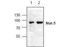 Image no. 1 for anti-Signal Transducer and Activator of Transcription 5A (STAT5A) antibody (ABIN127149) (STAT5A antibody)