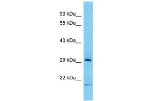 Western Blotting (WB) image for anti-Tryptase beta 2 (TPSB2) (Middle Region) antibody (ABIN2500609) (TPSB2 antibody  (Middle Region))