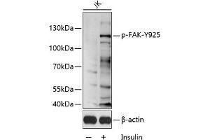 Western blot analysis of extracts of Jurkat cell line, using Phospho-FAK-Y925 antibody (ABIN6135297, ABIN6136216, ABIN6136217 and ABIN6225615) 1:1000 dilution.