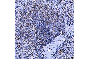 IHC analysis of SF3A1 using anti-SF3A1 antibody (ABIN7600556). (SF3A1 antibody  (AA 20-556))