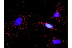 Proximity Ligation Analysis of protein-protein interactions between IGF1R and PIK3R3. (IGF1R antibody  (AA 1-1367))