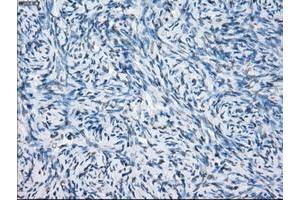 Image no. 4 for anti-Fc Fragment of IgG, Low Affinity IIa, Receptor (CD32) (FCGR2A) antibody (ABIN1497259)