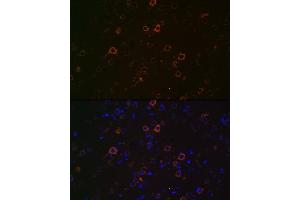 Immunofluorescence analysis of rat brain using Huntingtin Rabbit mAb (ABIN7267793) at dilution of 1:100 (40x lens). (Huntingtin antibody)