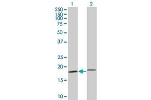 Western Blot analysis of PTH expression in transfected 293T cell line by PTH monoclonal antibody (M17), clone 3H7. (PTH antibody  (AA 32-115))
