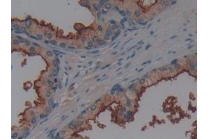 Detection of AAP in Human Prostate Tissue using Polyclonal Antibody to Alanine Aminopeptidase (AAP)