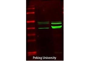 Western Blot (WB) analysis: Please contact us for more details. (CKM antibody  (N-Term))