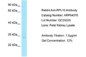 Western Blotting (WB) image for anti-Ribosomal Protein L10 (RPL10) (C-Term) antibody (ABIN2789821) (RPL10 antibody  (C-Term))