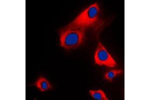 Immunofluorescent analysis of Glycerol Kinase 1 staining in H9C2 cells. (Glycerol Kinase 1 antibody  (C-Term))