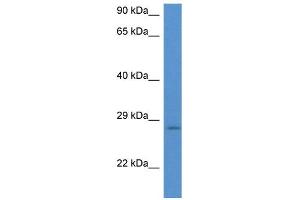 WB Suggested Anti-EIF6 AntibodyTitration: 1. (EIF6 antibody  (N-Term))