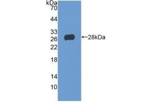 Detection of Recombinant TIGIT, Human using Polyclonal Antibody to T-Cell Immunoreceptor With Ig And ITIM Domains Protein (TIGIT) (TIGIT antibody  (AA 21-234))
