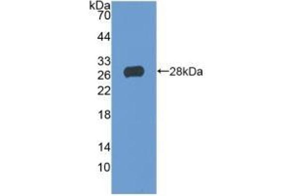 TIGIT antibody  (AA 21-234)
