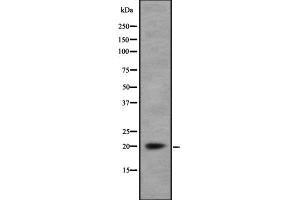Western blot analysis of MRP using Jurkat whole cell lysates (MARCKSL1 antibody  (Internal Region))