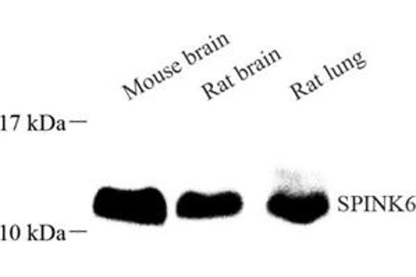 SPINK6 antibody