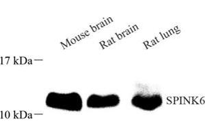 Western blot analysis of SPINK6 (ABIN7075551) at dilution of 1: 500