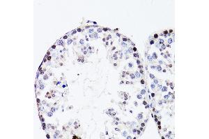 Immunohistochemistry of paraffin-embedded mouse testis using FGF12 antibody (ABIN3016419, ABIN3016420, ABIN1679841 and ABIN6219744) at dilution of 1:150 (40x lens). (FGF12 antibody  (AA 1-181))