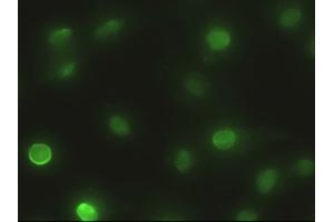 Anti-EpCAM mouse monoclonal antibody (ABIN2452363) immunofluorescent staining of HeLa cells transiently transfected by pCMV6-ENTRY EpCAM (RC201989) (EpCAM antibody  (AA 24-265))