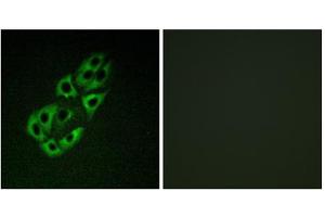 Immunofluorescence analysis of A549 cells, using MtSSB antibody. (SSBP1 antibody  (C-Term))