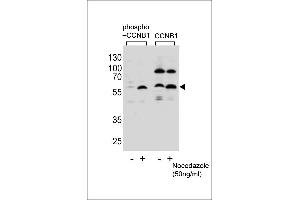 Western blot analysis of lysate from Hela cells(from left to right),untreated or treated with Nocodazole at 50 ng/mL,using Phospho-CCNB1-S35 Antibody (ABIN1881155 and ABIN2839973) or CCNB1-S9 Antibody. (Cyclin B1 antibody  (pSer35))