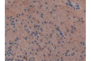#VALUE! (NEFL antibody  (AA 139-234))