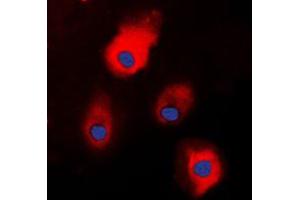 Immunofluorescent analysis of S100-A1 staining in HEK293T cells. (S100A1 antibody  (N-Term))