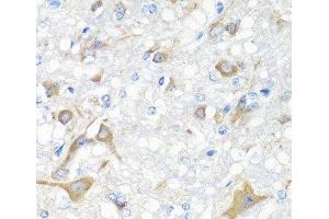 Immunohistochemistry of paraffin-embedded Rat brain using IL22 Polyclonal Antibody at dilution of 1:100 (40x lens). (IL-22 antibody)