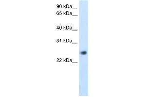 WB Suggested Anti-GGTLA4 Antibody Titration:  5. (GGTLC1 antibody  (C-Term))