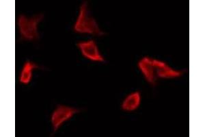 ABIN6269295 staining NIH-3T3 by IF/ICC. (14-3-3 zeta antibody  (Internal Region))