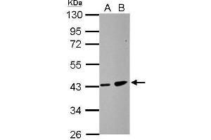 WB Image Sample (30 ug of whole cell lysate) A: HCT116 B: MCF-7 10% SDS PAGE antibody diluted at 1:500 (ZDHHC11 antibody)