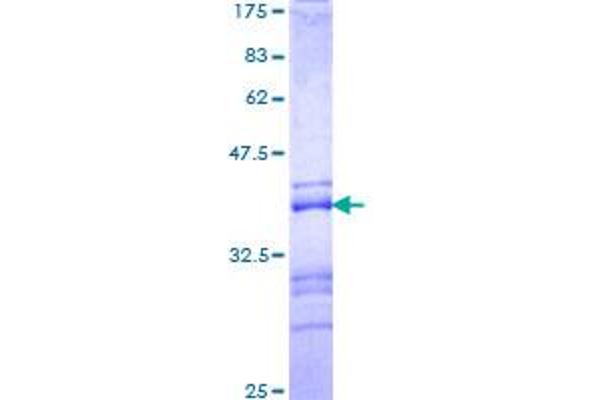ADNP Protein (AA 1018-1102) (GST tag)