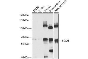 Western blot analysis of extracts of various cell lines, using SGSH antibody (ABIN6129760, ABIN6147711, ABIN6147712 and ABIN6224170) at 1:1000 dilution. (SGSH antibody  (AA 273-502))
