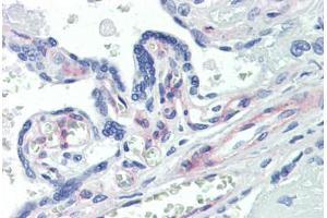 Human Placenta (formalin-fixed, paraffin-embedded) stained with PDGFRB antibody ABIN462353 followed by biotinylated anti-mouse IgG secondary antibody ABIN481714, alkaline phosphatase-streptavidin and chromogen. (PDGFRB antibody)
