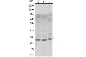 Western blot analysis using CD69 mouse mAb against, Jurkat (1), L1210 (2) and TPH-1 (3) cell lysate. (CD69 antibody)