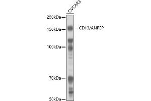 Western blot analysis of extracts of OVC cells, using CD13/ANPEP antibody (ABIN6131185, ABIN6136911, ABIN6136912 and ABIN6221309) at 1:1000 dilution. (CD13 antibody  (AA 668-967))