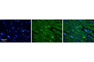 Rabbit Anti-SLC40A1 Antibody   Formalin Fixed Paraffin Embedded Tissue: Human heart Tissue Observed Staining: Plasma membrane in intercalated disk Primary Antibody Concentration: 1:100 Other Working Concentrations: N/A Secondary Antibody: Donkey anti-Rabbit-Cy3 Secondary Antibody Concentration: 1:200 Magnification: 20X Exposure Time: 0. (SLC40A1 antibody  (Middle Region))