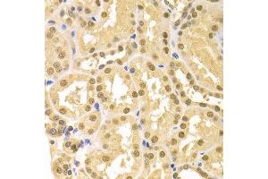 Immunohistochemistry of paraffin-embedded human kidney using SFN Antibody. (14-3-3 sigma/SFN antibody  (AA 1-248))