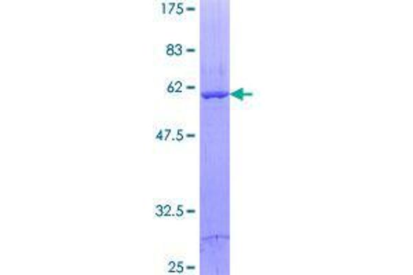 DECR2 Protein (AA 1-292) (GST tag)