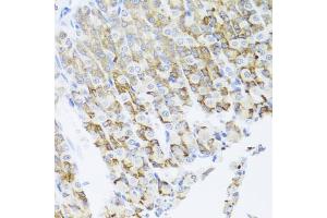 Immunohistochemistry of paraffin-embedded mouse stomach using PIK3CA antibody (ABIN6292231) at dilution of 1:100 (40x lens). (PIK3CA antibody)