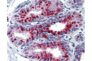 Immunohistochemistry (IHC) image for anti-Potassium Channel, Subfamily K, Member 9 (KCNK9) (N-Term) antibody (ABIN2776216) (KCNK9 antibody  (N-Term))
