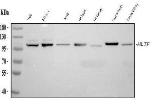 Western blot analysis of HLTF using anti-HLTF antibody (ABIN4886619). (HLTF antibody  (AA 911-1009))